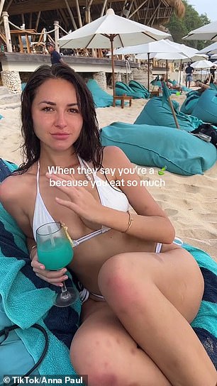 24-летняя звезда OnlyFans рассказала о внезапной потере веса и синяках на ногах в видеоролике, где она отдыхает в воскресном пляжном клубе на Бали.