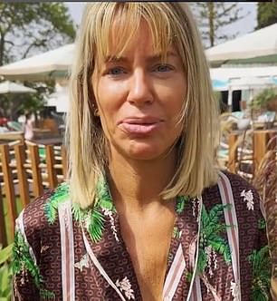 Новое лицо, новый я: на прошлой неделе Кэролайн рассказала, что сделала подтяжку лица в Лос-Анджелесе «без какой-либо информации» (на фото в июле)