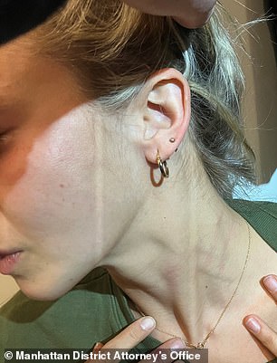 Доказательства, представленные суду, показывают опухший палец Джаббари и следы на ее шее.
