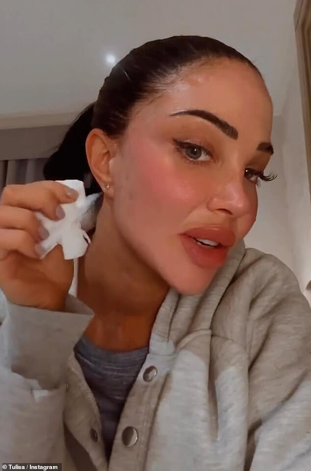 36-летняя Тулиса рассказала, что в будущем ей сделают «пересадку жира», чтобы избавиться от синяков на лице, которые делают ее «параноиком», сказала она фанатам в субботу.